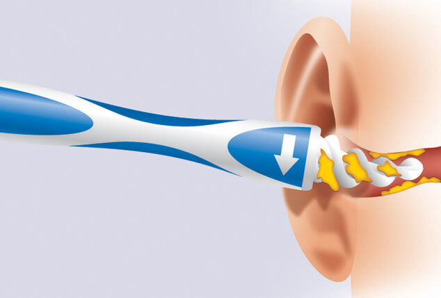 Cure-oreille avec embouts et boîte de rangement supplémentaires