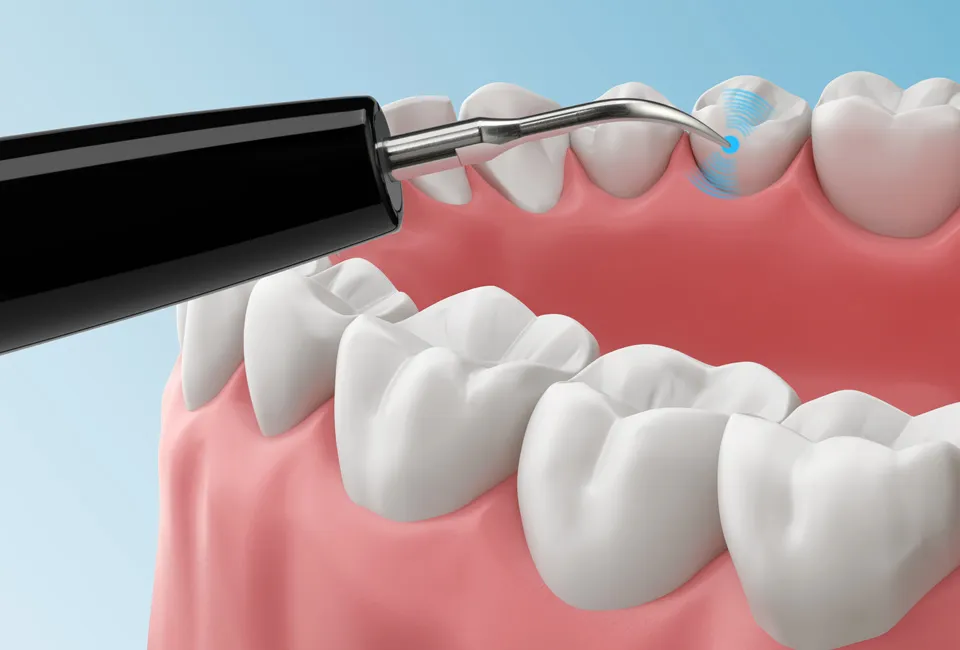 Ultrasonic tooth cleaner with 5 settings
